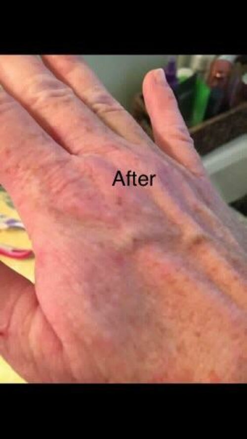 No More Eczema – Luxury Organic Handmade Soap | Gentle Skin Comfort Bar